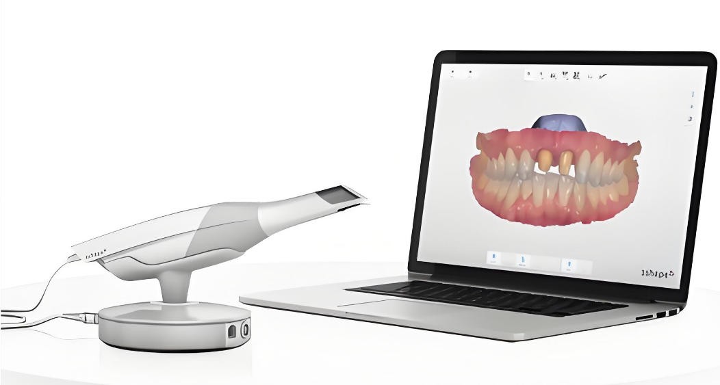 三維口內掃描儀